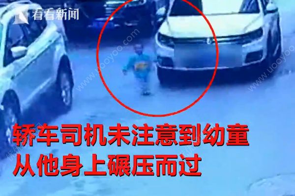 幼童玩躲貓貓慘遭轎車碾壓，危在旦夕，警方已介入(1)