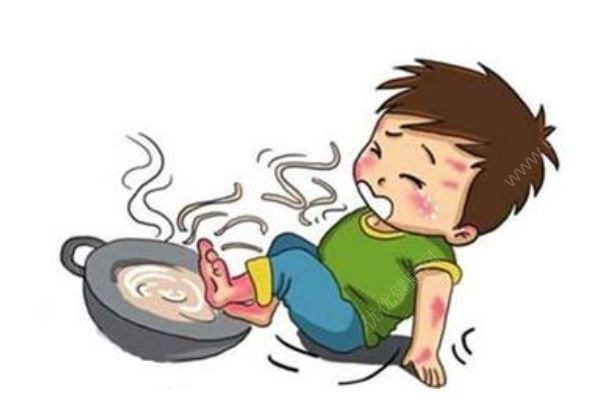 4歲男孩一屁股坐進開水桶，全身65%燙傷，燙傷急救處理方法(1)