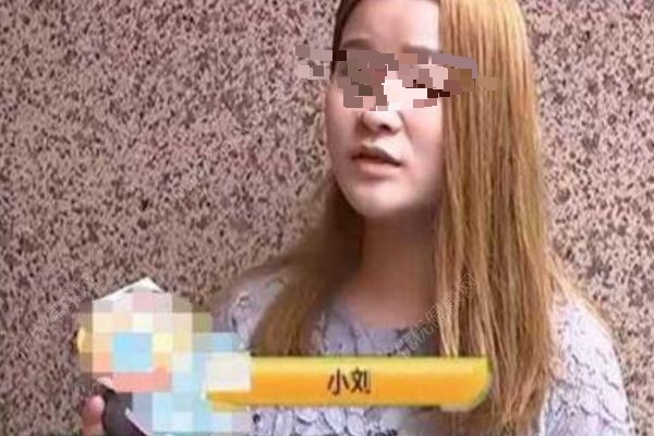 女子花5300元割雙眼皮，3年后想退款：左眼是四眼皮(2)