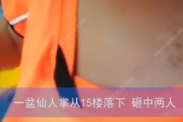 仙人掌從15樓掉落，男孩身上多處被砸成馬蜂窩(2)