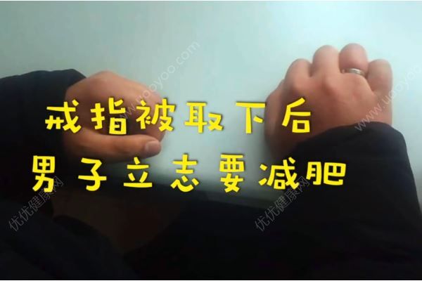 男子春節(jié)吃的太胖，戒指卡手上取不下來(4)