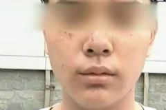 打籃球13歲少年被抓成花臉，如何解決廣場舞擾民問題[多圖]