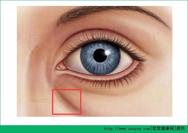 臥蠶和黑眼圈有什么區(qū)別？臥蠶和眼袋有什么區(qū)別？(4)