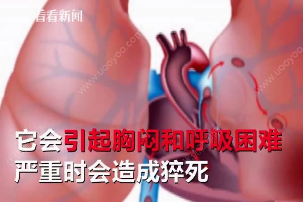 男子打麻將久坐不起險猝死，打麻將猝死是什么原因？(3)