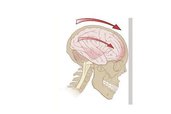 男子樓梯墜下昏迷，8個(gè)月大兒子哭鬧將其喚醒(4)