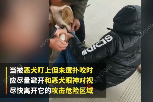 惡犬撲咬無路逃！下一步你該咋辦？(1)