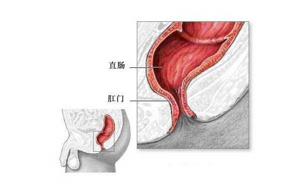 冬天拉屎大便出血怎么回事？冬天便血飲食調(diào)理方法(2)