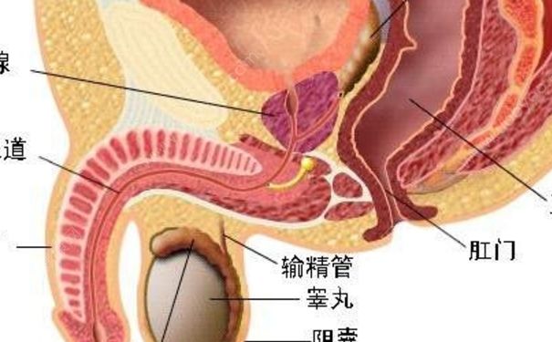 前列腺炎鈣化是什么？前列腺炎鈣化能治好嗎？(1)