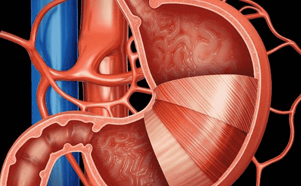 胃癌患者切除胃后怎么吸收營養(yǎng)？切除胃后吃什么好？(1)