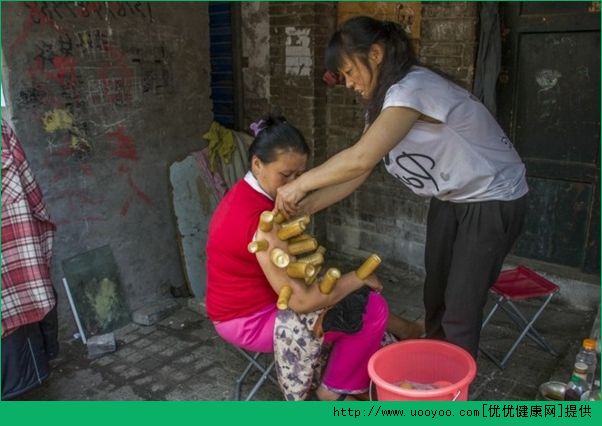 拔火罐有什么作用？拔罐的好處有哪些？(3)