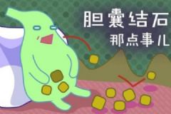 哪些人最容易得膽結(jié)石？膽結(jié)石有哪些明顯特征？[多圖]