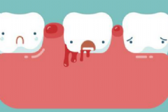 牙齦出血的治療方法有哪些？牙齦出血的注意事項(xiàng)有哪些？[圖]