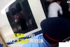 三胞胎孕婦火車上大出血，孕婦大出血該怎么辦？[多圖]