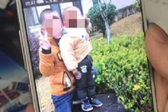 10歲男孩沖進(jìn)火場救4歲弟弟全身被燒傷，被燒傷后怎么辦？[多圖]