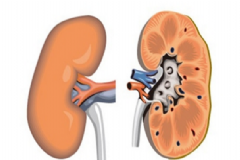 腎炎該怎么治療最好？腎炎有傳染性嗎？[圖]