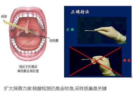 核酸檢測新冠病毒的常用手段：口腔拭子、鼻腔拭子檢測圖解