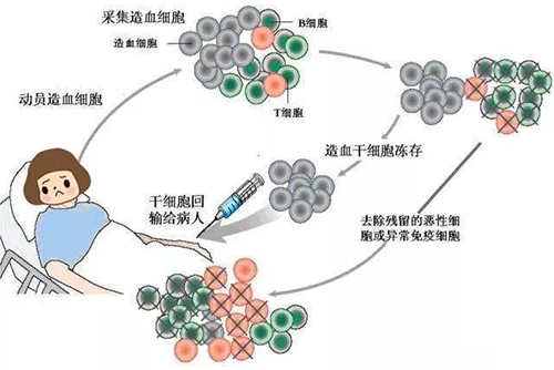 濟(jì)南血液病醫(yī)院：治療淋巴瘤自體造血干細(xì)胞移植效果咋樣？