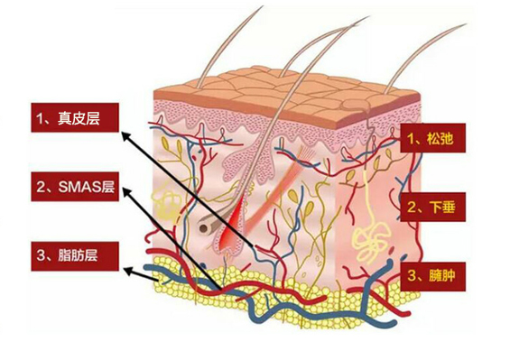 什么是赫本線？聯(lián)合麗格向淑英抗衰新理念：45°赫本線緊致術(shù)