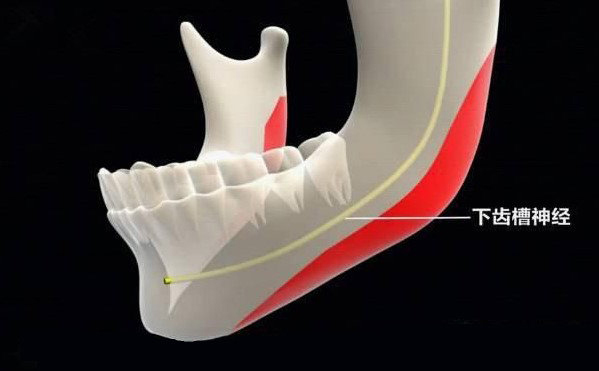 聯(lián)合麗格第一醫(yī)院何照華教授：下頜角手術(shù)會不會損傷神經(jīng)線？