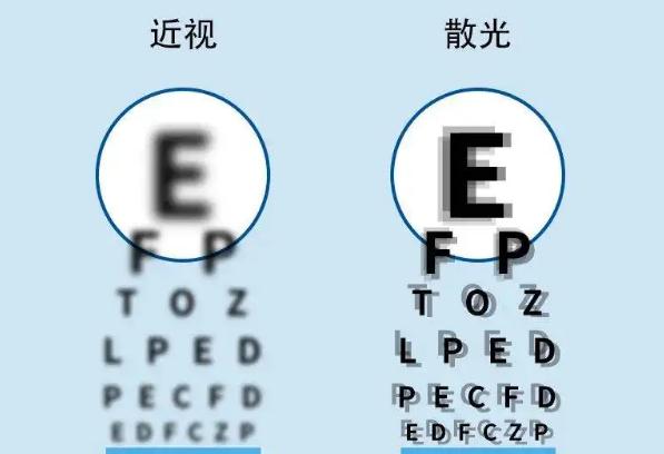 散光的癥狀有哪些？散光可以戴隱形眼鏡嗎？