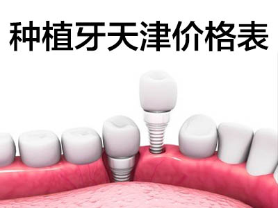 拔牙種牙大概多少錢 天津東麗拔牙種牙多少錢一顆啊