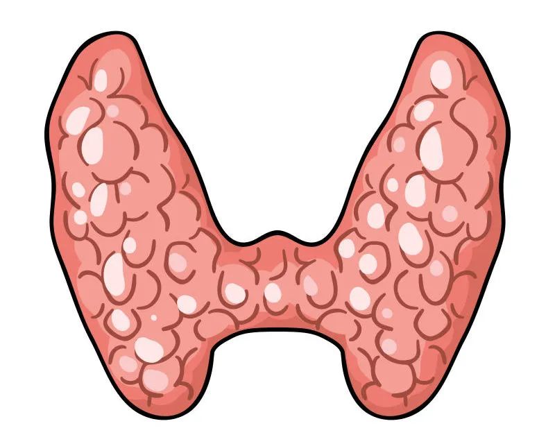 當(dāng)心！成都民生耳鼻喉醫(yī)院：身體有這幾種表現(xiàn)，說明你的甲狀腺出了問題！