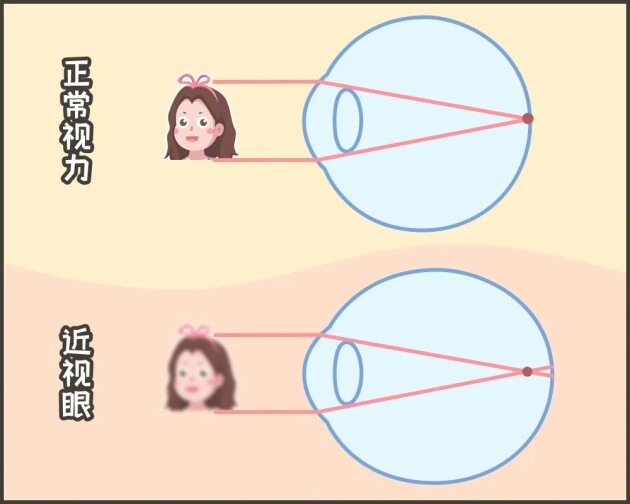 合肥愛爾：「我可以治好你的近視，但不改變度數(shù)?！股?？