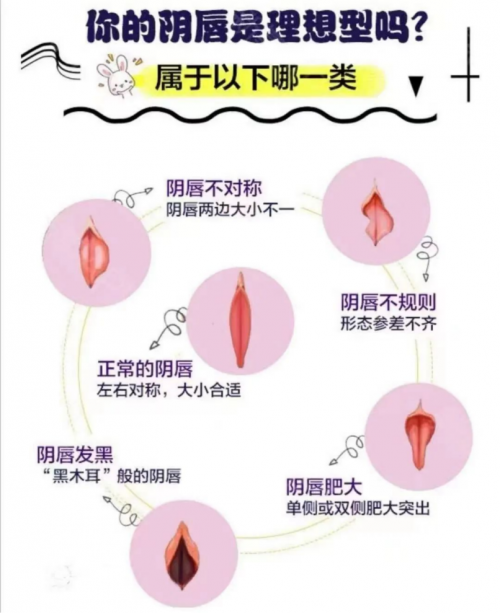 昆明做陰唇整形會留疤嗎？多久能恢復呢？