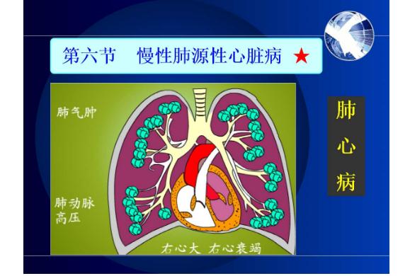 冠心病是心臟病嗎？什么是肺源性心臟病？