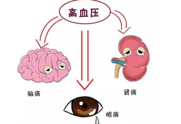 高血壓有哪幾種類型？高血壓要做些什么檢查項(xiàng)目？