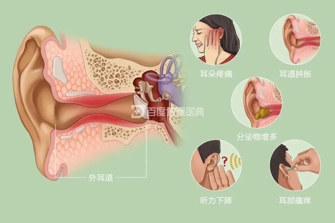 兒童患”流感“為什么會耳朵疼？成都民生耳鼻喉醫(yī)院專家解答原因 國家三級醫(yī)院