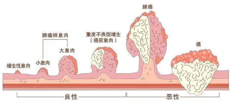  揚州妙手醫(yī)院睡眠式無痛胃腸鏡檢查，不僅準確，而且“快速”