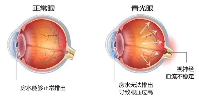 株洲愛爾代敏丨為“獨眼”女子守住最后一絲光明！