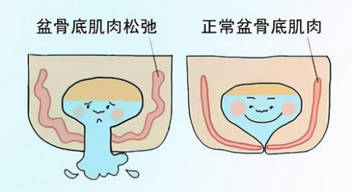 在昆明關(guān)于陰道松弛，你一定要知道的這些問題