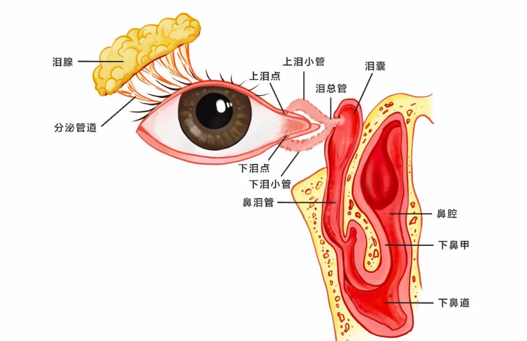 合肥愛爾眼科：女孩流淚8年？！原來是淚道堵塞！