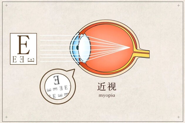 【直播預(yù)告】開學(xué)第一課，名醫(yī)名師教你近視管理和專注力提升，以最佳狀態(tài)為新學(xué)期開篇！