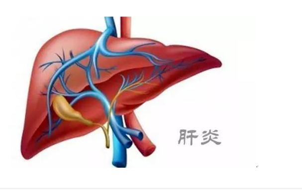 A型肝炎是什么病？A型肝炎常見知識？