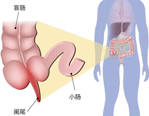 慢性闌尾炎b超能看到嗎 慢性闌尾炎檢查什么項(xiàng)目