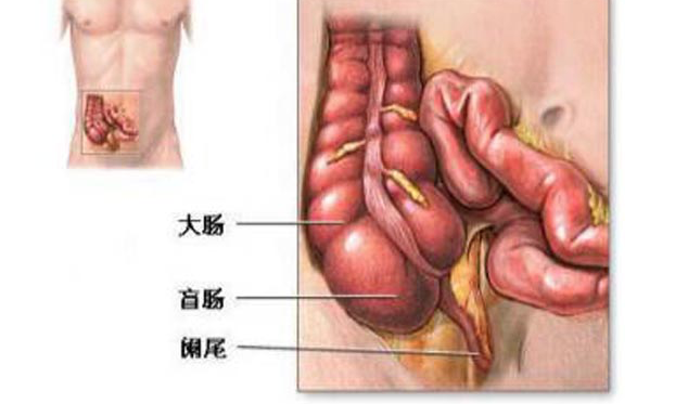 闌尾炎手術(shù)后能跑步嗎 闌尾炎手術(shù)后怎么養(yǎng)護