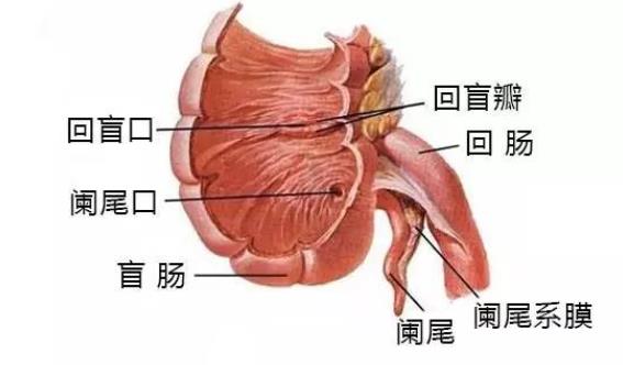 闌尾炎能治好嗎 慢性闌尾炎會變成急性闌尾炎嗎？