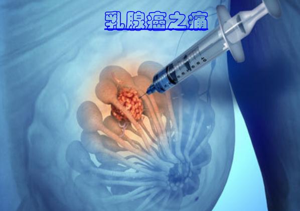 這些食物可以預(yù)防乳腺癌 ？乳腺癌手術(shù)后多久化療？