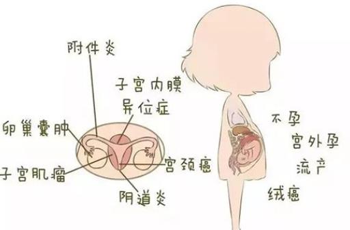 卵巢囊腫就是癌癥嗎 怎么判斷卵巢囊腫是惡性還是良性的