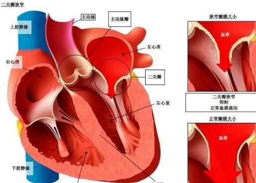 心臟瓣膜病可以治愈嗎 心臟瓣膜不舒服有哪些原因