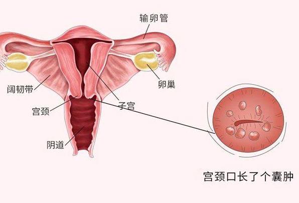 宮頸癌疫苗間隔多長時間 打人乳頭瘤疫苗注意什么