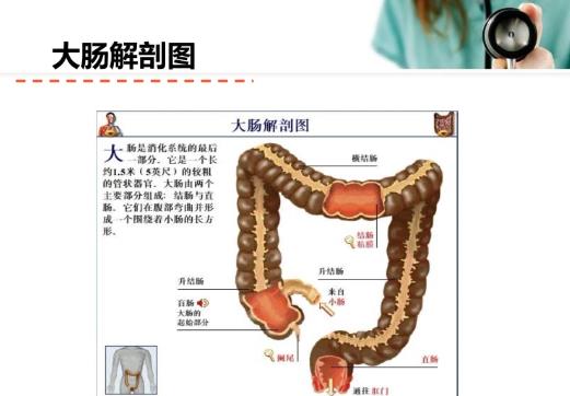 直腸癌便血是晚期了嗎 直腸癌便血顏色什么樣