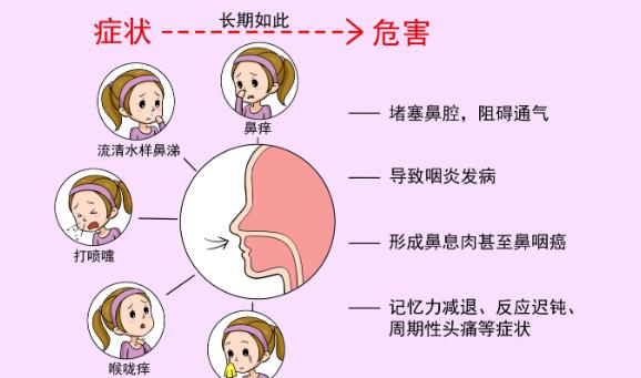 過敏性鼻炎會引起咳嗽嗎 過敏性鼻炎會引起結(jié)膜炎嗎