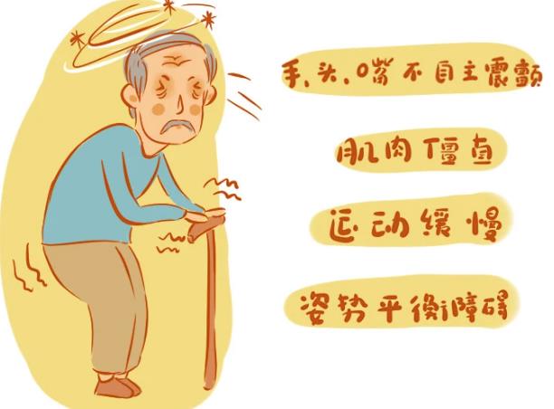 帕金森手術(shù)后會(huì)復(fù)發(fā)嗎 帕金森怎么治療